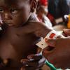 © 2012 Emiliano Albensi/Albefotografiche.net, Courtesy of Photoshare. Bodiko, 3 years old and weighing only 6.8 kg, is one of several children in Bangui, Central African Republic, who are being treated for malnutrition by UNICEF and other NGOs.